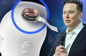 «نيورالينك» تزرع شرائح الدماغ لدى 12 شخصا  