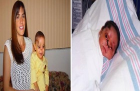 يتحدى التوقعات بعد ولادته دون أنف وإجراء 30 جراحة