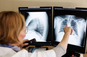 «هزيمة» للذكاء الاصطناعي على يد أطباء 