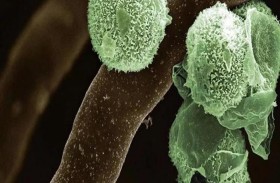 العراق: لا يوجد خطورة من الفطر الأسود والأخضر