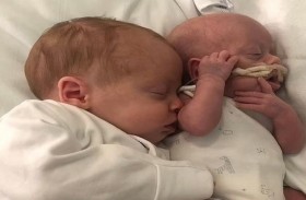 نجاة رضيع يزن 500 غرام بفضل شقيقه التوأم