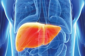 كيف يسبب الكحول تراكم الدهون في الكبد؟