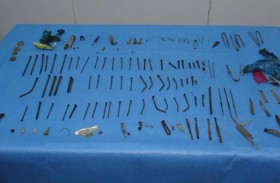 فتاة تبتلع مقصاً وسكيناً وإبراً