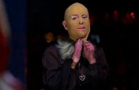 مصابة بلهيب بركان مدمر تكشف عن وجهها لأول مرة