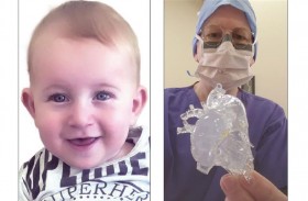 صحة تحقق إنجازاً طبياً بنجاحها في علاج مولود كان يعاني من تشوهات خلقية في القلب