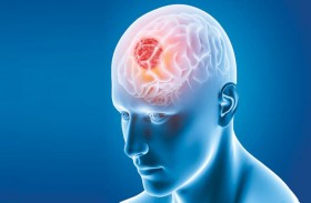 روائح غير عادية قد تشير إلى وجود ورم في الدماغ