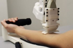 روبوت ثوري لسحب الدم يرى تحت الجلد