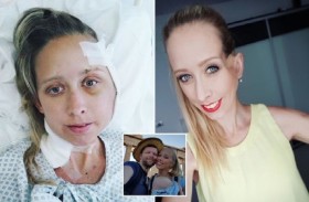 تخضع لعملية جراحية تترك حفرة في وجهها