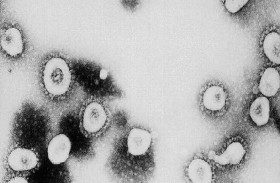 ما المدة الفاصلة بين عدوى كورونا واكتشافها في الفحص؟