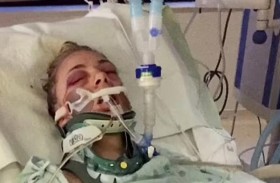 تقتلع عينيها بيديها تحت تأثير المخدرات