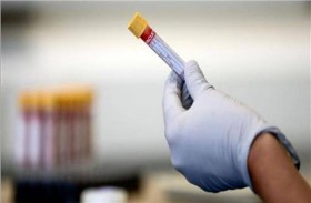 علاج مرتقب لـ«كورونا» باستنساخ الأجسام المضادة