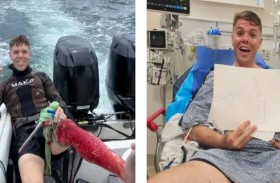 ابتسامة صياد غارق في الدماء بعد هجوم سمكة قرش