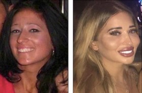 تنفق 100 ألف دولار على تغيير مظهرها