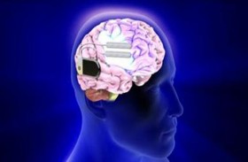 خوارزمية تساعد في علاج الصرع