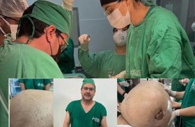 إزالة ورم وزنه  45 كلغ من امرأة 