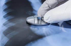 عقار جديد يعالج الدرن في شهرين فقط