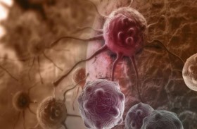 نوعان من الأطعمة ينبغي تجنبهما للمساعدة في تقليل مخاطر الإصابة بالسرطان