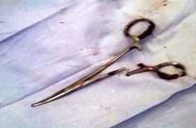 مقص في بطن امرأة دام عامين