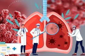 علاج مركّب من الأجسام المضادة وحيدة النسيلة يُظهر فعالية كبيرة ضد 