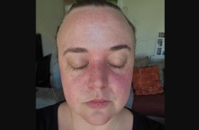 حالة نادرة تتسبب في غلق عينيها أثناء القيادة