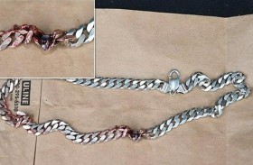 قلادة معدنية تنقذ رجلا من «رصاصة الموت»