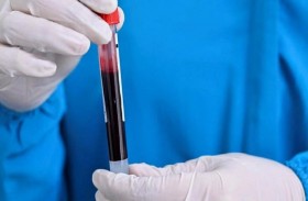 فحص جديد يرصد 50 نوعا من السرطان قبل ظهورها