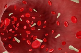 الباحثون يكشفون من هم الأكثر عرضة لخطر الإصابة بالإنتان!