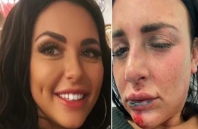 تقفز من الشرفة بسبب غيرة شريكها