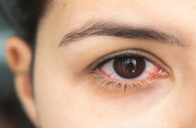 علامات صحية خطيرة تكشفها العيون!