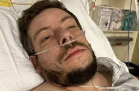 ينجو من الموت بعد «عطسة عنيفة»