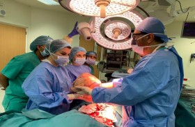 أطباء مستشفى الجامعة بالشارقة ينجحون باستئصال ورم ليفي يزن 6 كيلوجرام من رحم مريضة بعمر 28 عاماً