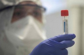 تحورات سريعة لجدري القردة تحير العلماء