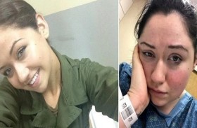 الحساسية تجعلها محبوسة في السرير