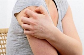 أعراض تنذر بالتهاب الغدد العرقية القيحي
