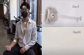 جهاز ذكي لمرضى القلب يذوب عند الانتهاء من مهمته