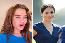 نمش صناعي مستوحى من ميغان ماركل