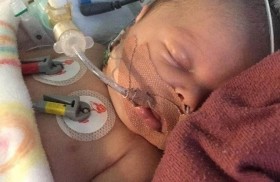 طفل ينجو من 3 نوبات قلبية سببتها نقطة حليب