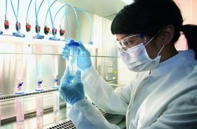 علماء يكتشفون سبب مرض الذئبة