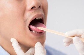 طبيب يقيم خطورة الإصابة بداء كثرة الوحيدات