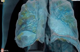 هكذا يدمر فيروس كورونا الرئتين 