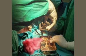 طفل يتقيأ ديدانًا عملاقة بعد تناول ماء ملوث!