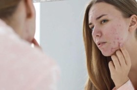 الحمل والبشرة.. احتياطات مهمة لسلامة الأم والجنين