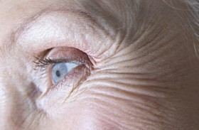 أخطاء شائعة تسرّع ظهور التجاعيد العميقة ونصائح للوقاية منها