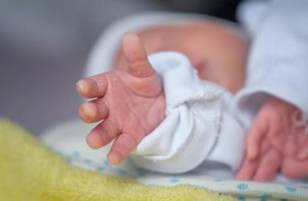 طفل يولد بثمانية أطراف ووجهين