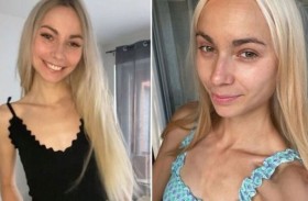 تعاني من حالة تجعلها تأكل كيلو زبدة كل يوم