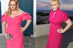 جراح تجميل ينقذ ريبيل ويلسون من تشوّه دائم 