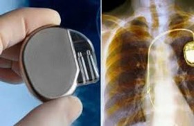 هل تؤثر الأجهزة الإلكترونية على منظم ضربات القلب؟