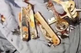 مفاتيح ومقصات وسكيناً في بطن مريض 