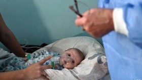 اكتشاف مشكلات رئوية مستترة في أطفال أصيبوا بكوفيد- 19 