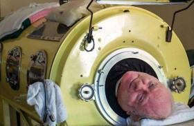 وفاة رجل قضى حياته داخل رئة حديدية